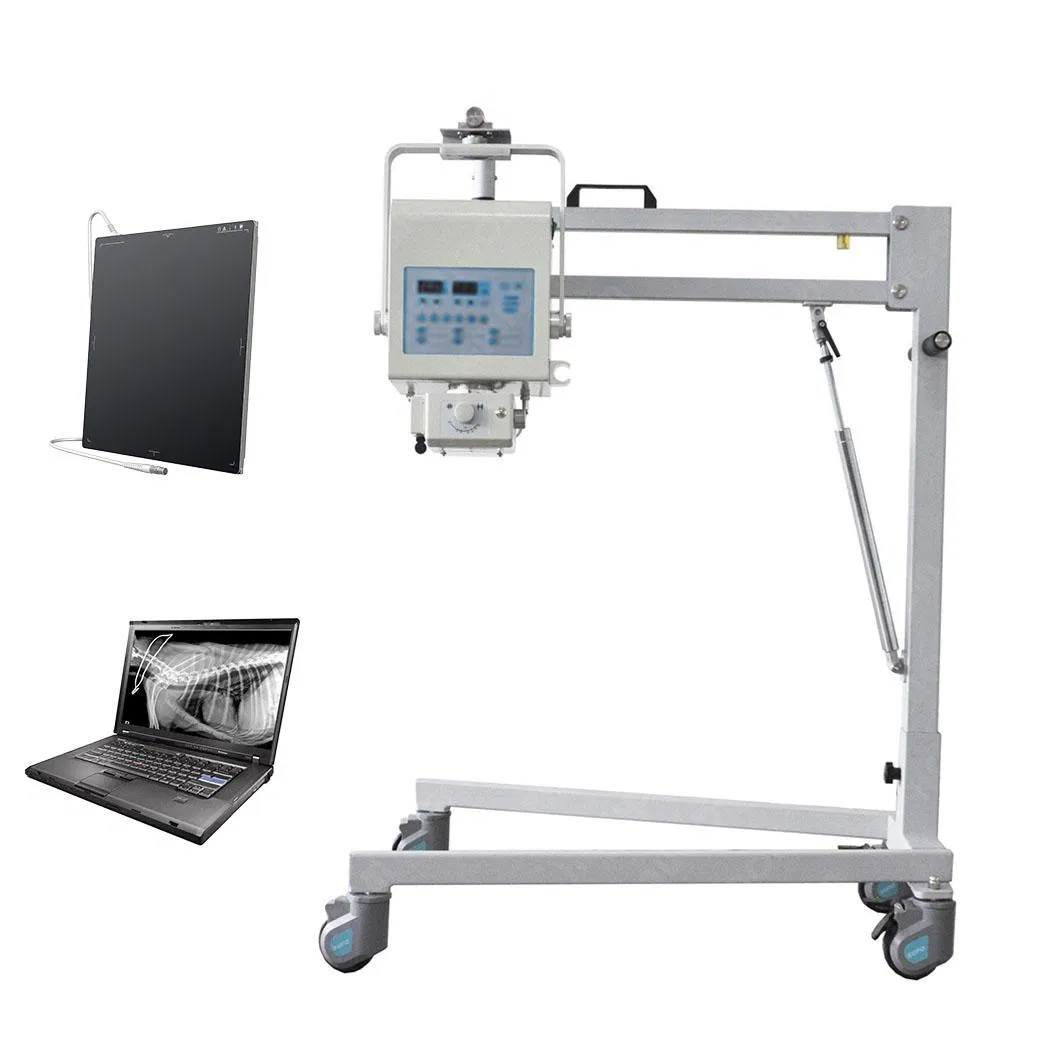 X Ray Diagnosis Equipment