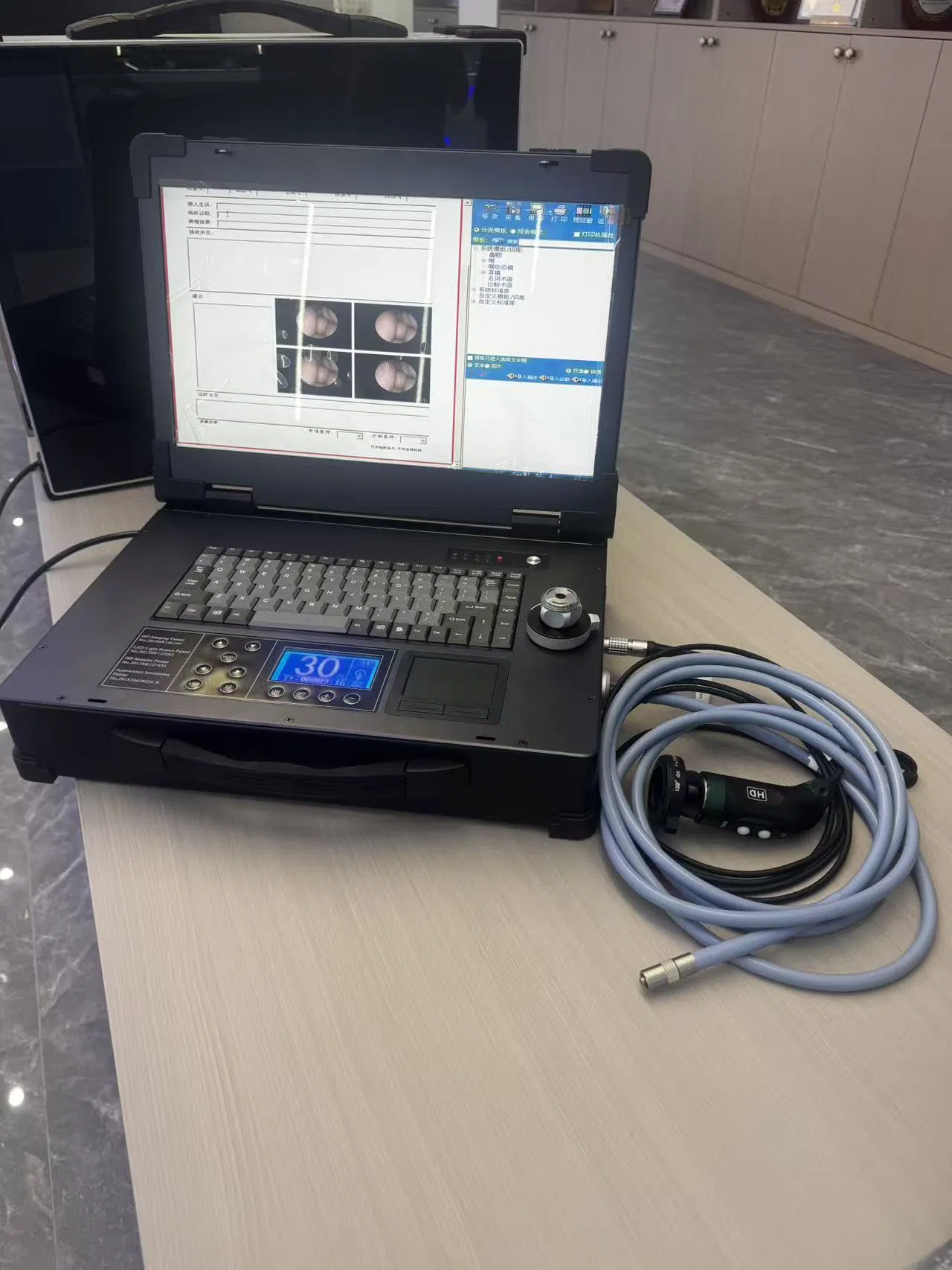 Dual-Mode HD Portable Camera System Built-in Printing Function &amp; Workstation for Diagnostic