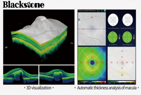 Velite C800 CE-Certified Intelligent Oct Diagnostic System