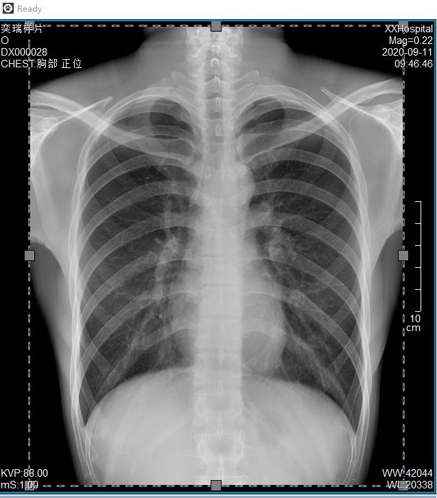 Careray Medical Mammography Diagnostic Portable 17"17" Wireless Dr X Ray Flat Panel Detector