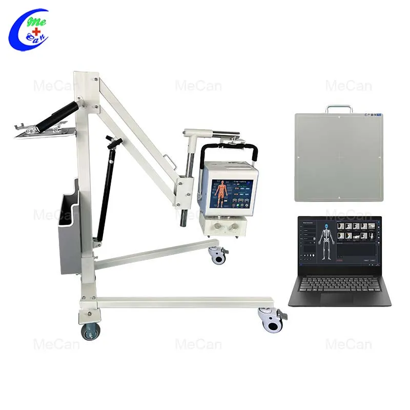 Portable X Ray Machine