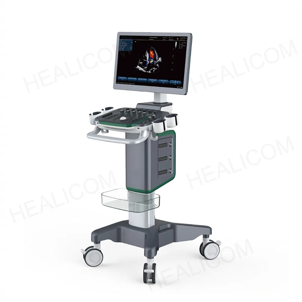 High Resolution All Digital Color Doppler System 4D Real-Time Imaging Medical Ultrasound Scanner with Dual Screen