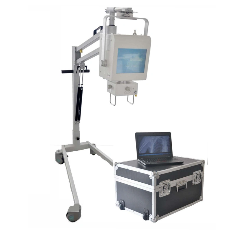 China High Quality My-D019d Hospital Mobile 100mA Digital Xray Portable X-ray Equipment