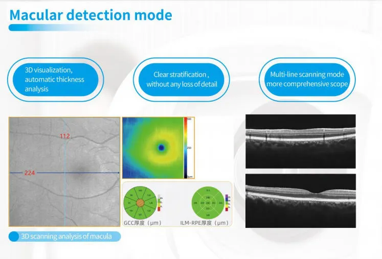 Retinal Analysis