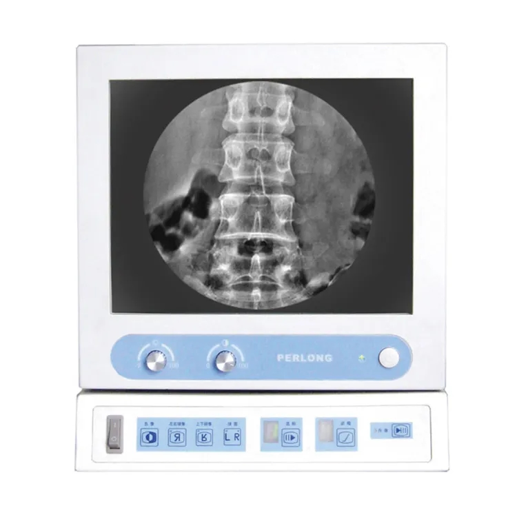 Medical Equipment Digital Mobile X Ray C Arm System