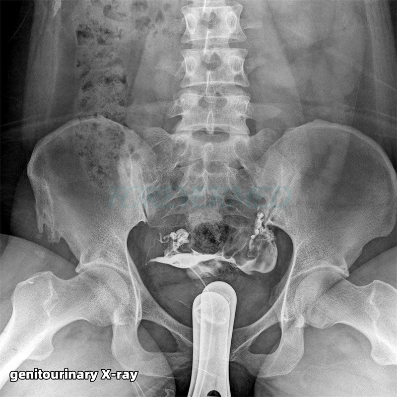 Advanced Dynamic Digital Radiography and Fluoroscopy Imaging System