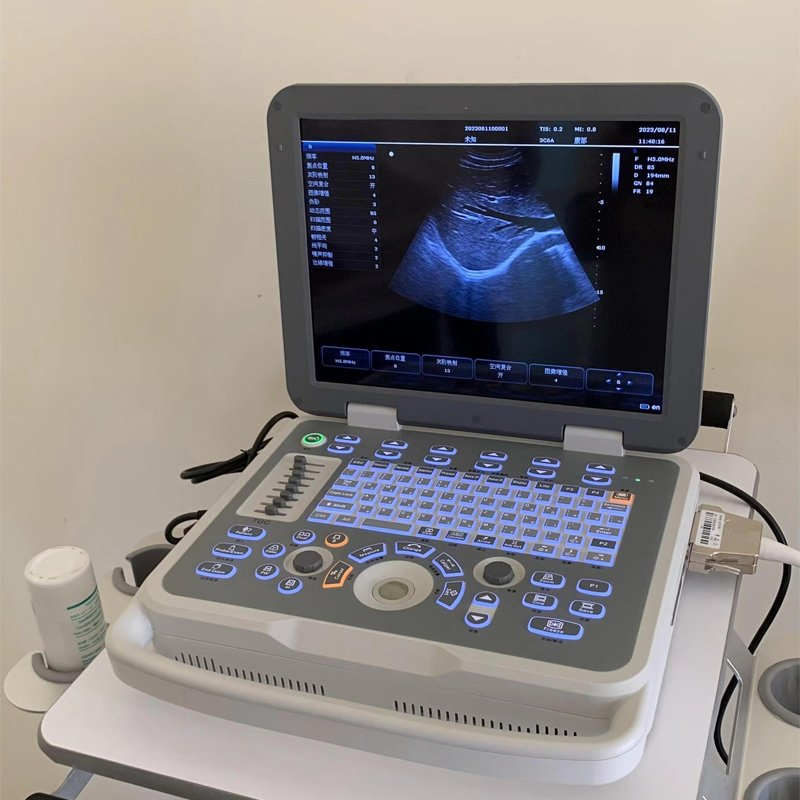 High-Resolution Umus068 Ultrasound System with Dual Real-Time Imaging &amp; Dicom Support