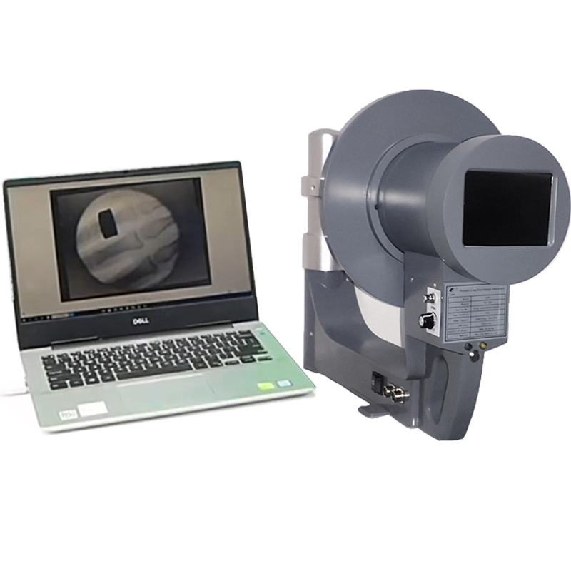 Juzheng X-ray Machine Medical Fluoroscopy Portable X Ray Device