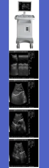 UT1000 Ultrasound System Trolley