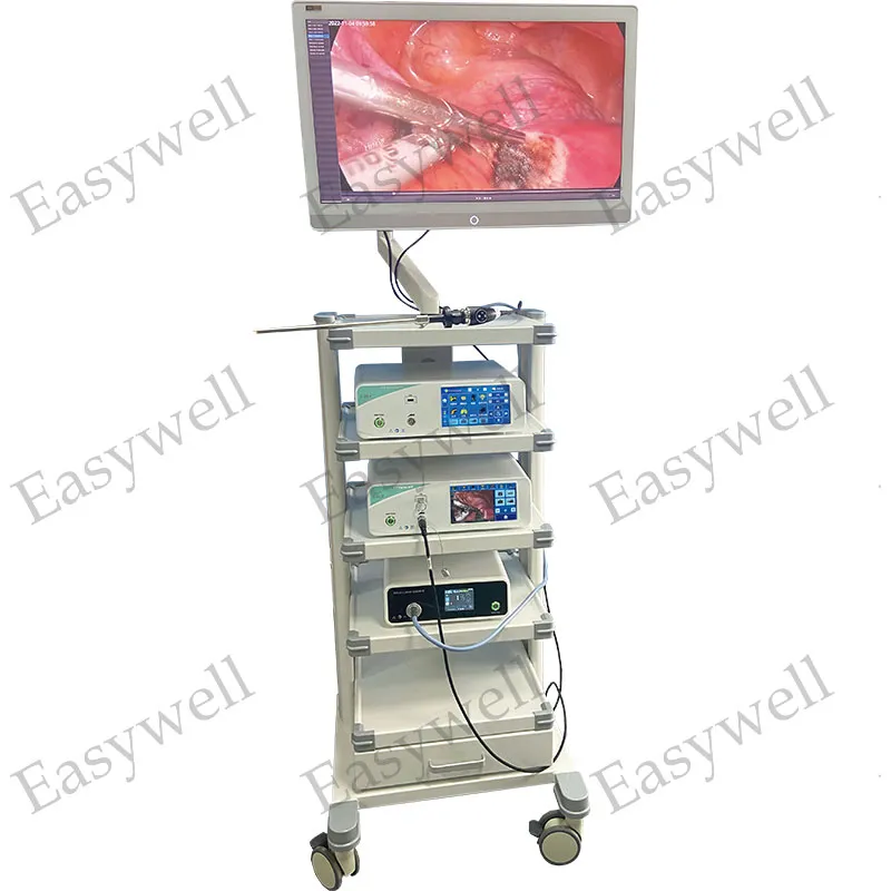 UHD Endoscopy Camera System