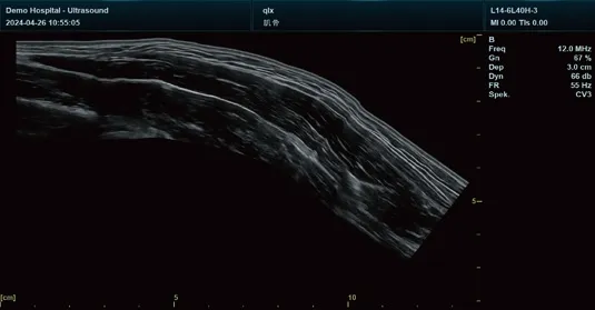Doppler Imaging Interface