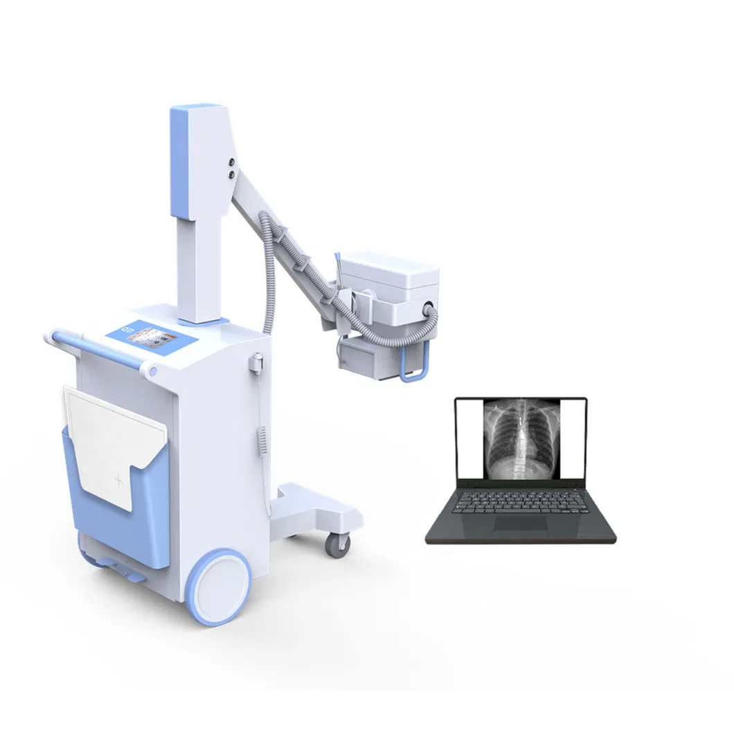 Digital X-ray System