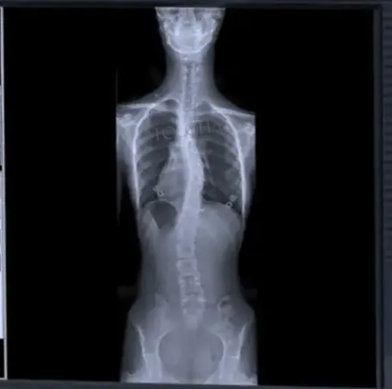 Thr-Xr-8500c High Frequency Digital Radiography System