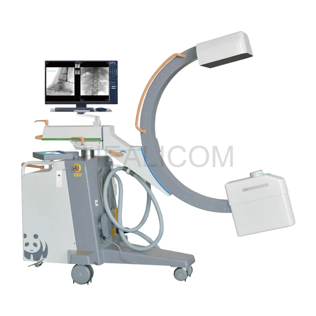 Mobile Digital C-arm System