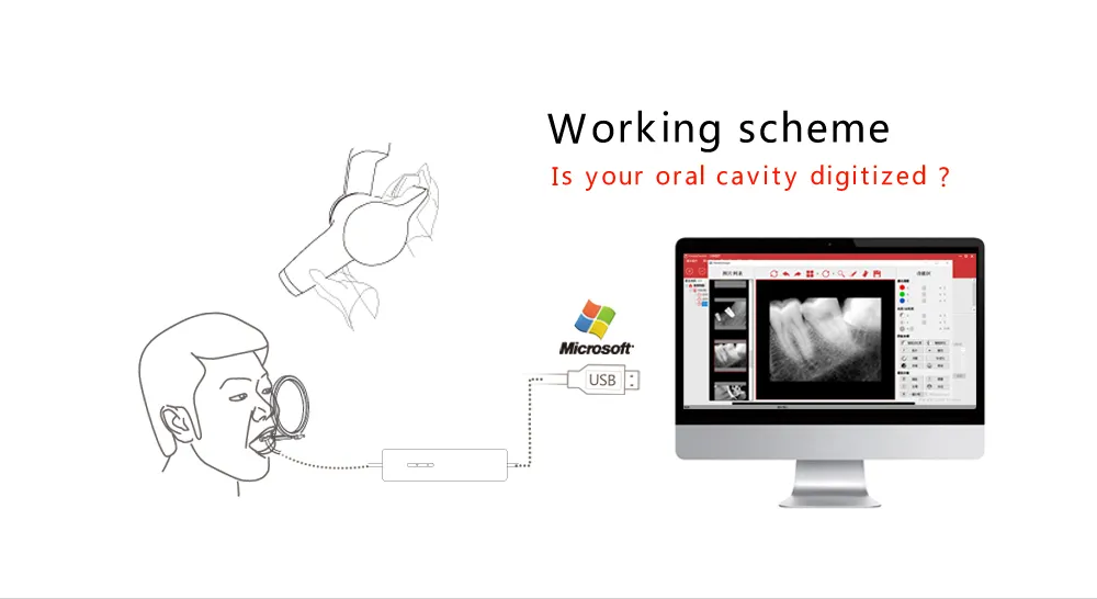 Dental Sensor Detail