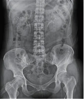 56kw/80kw High Quality Digital Dynamic Detector Radiography Fluoroscopy X Ray System