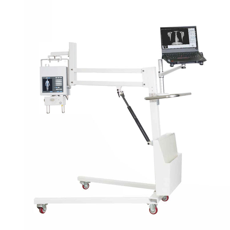 Hospital Radiology Mobile Analogue or Digital Medical X-ray Equipment