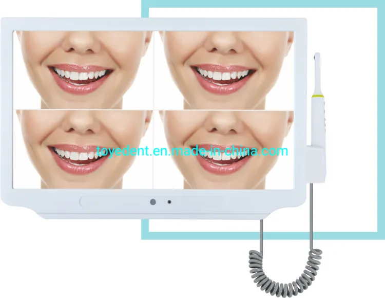 Dental Endoscope Display