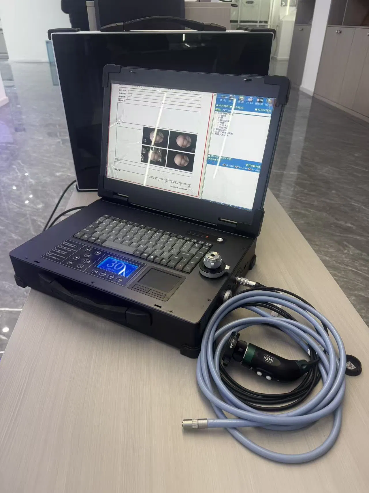 Dual-Mode HD Portable Camera System Built-in Printing Function &amp; Workstation for Diagnostic