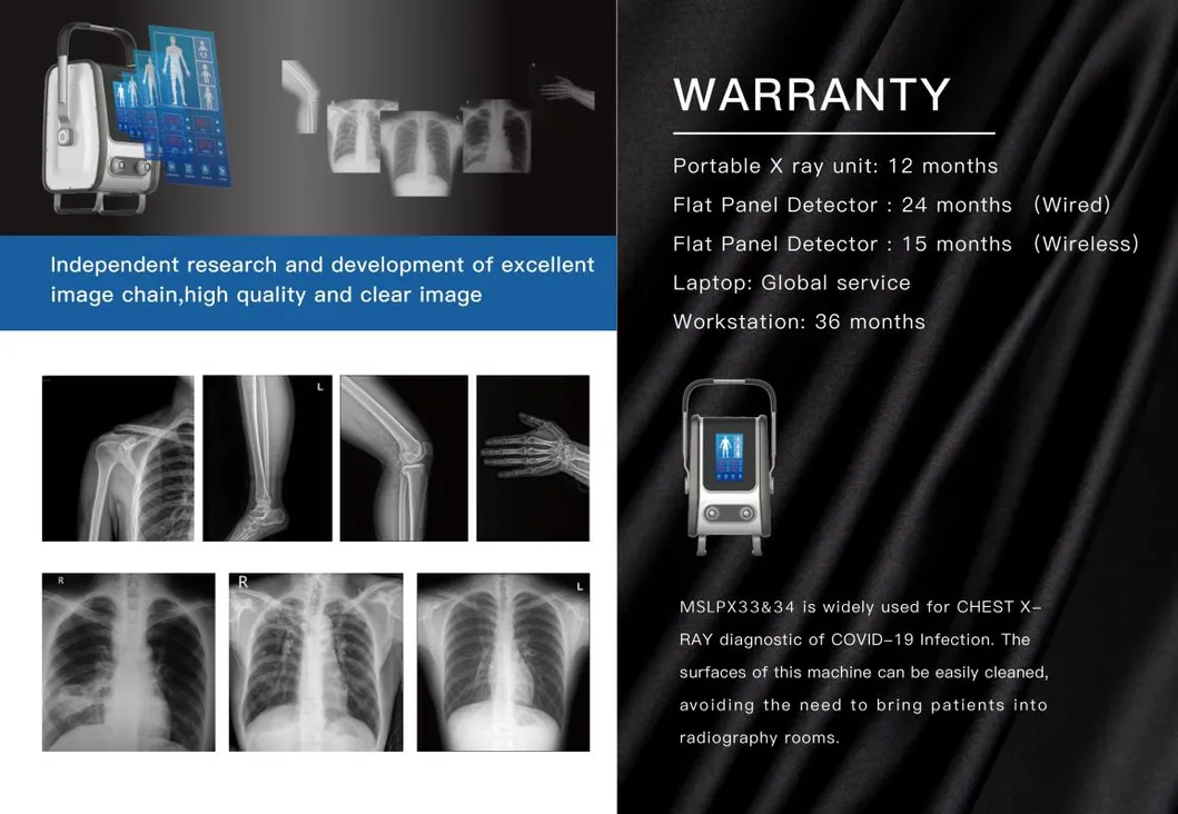 Chest Xray Machine Price