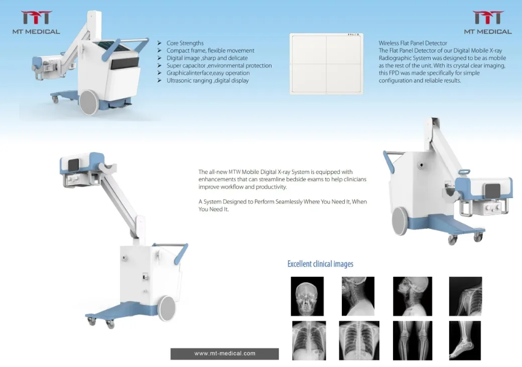 X-ray System Detail 2