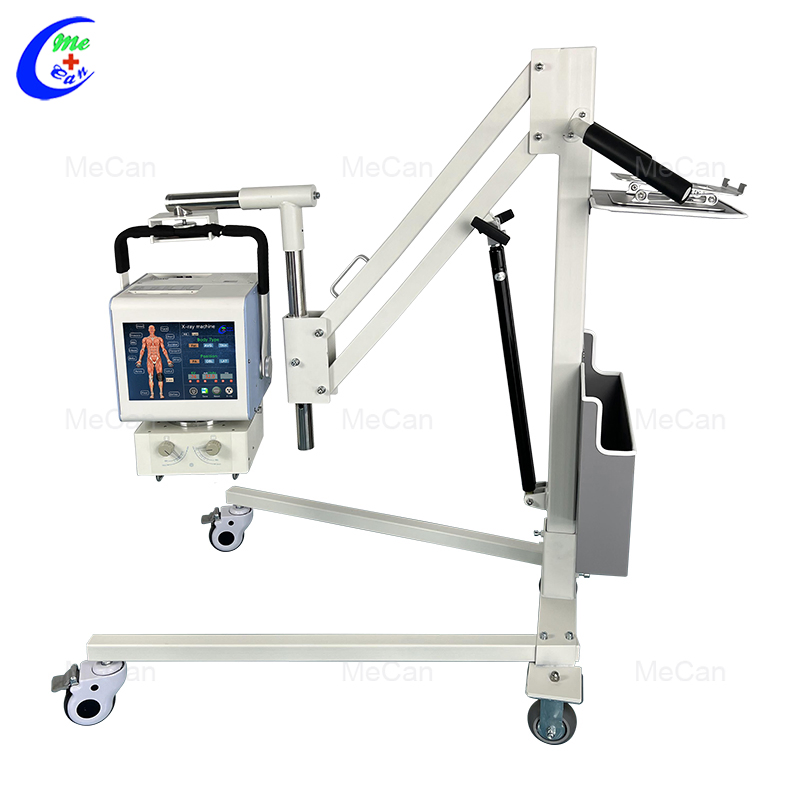Low Price Digital 5kw 100mA Hospital Xray Radiology Equipment