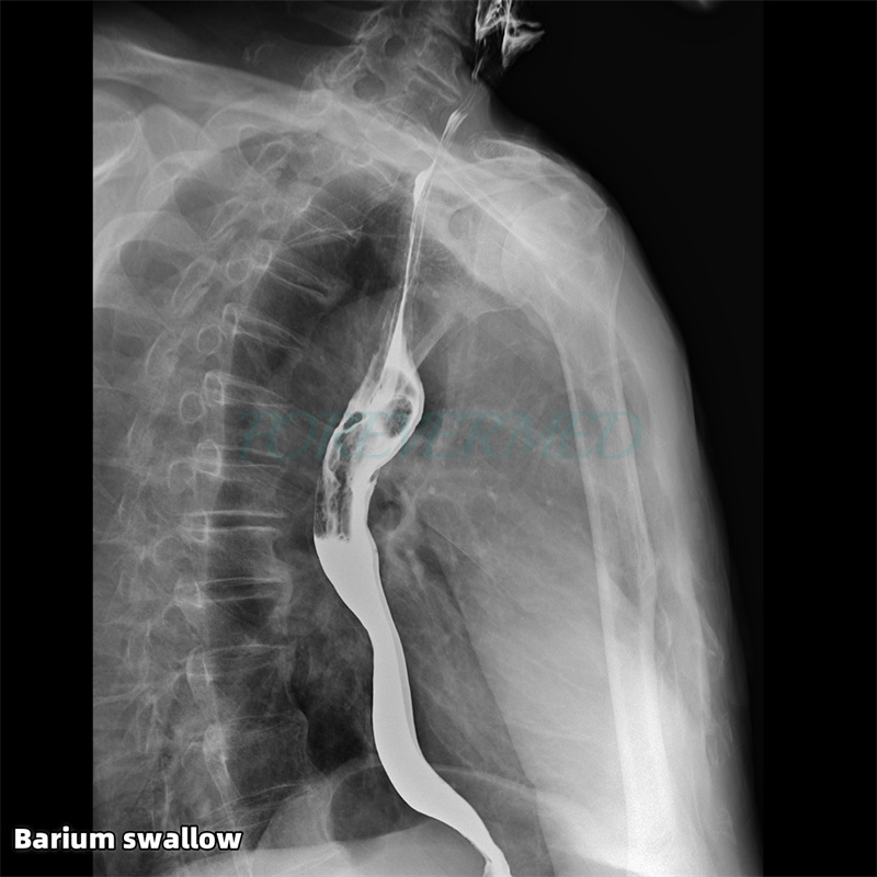 Advanced Dynamic Digital Radiography and Fluoroscopy Imaging System
