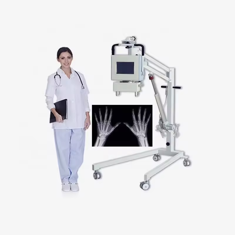 Portable Medical X-ray Device for Efficient Imaging High Frequency Handheld