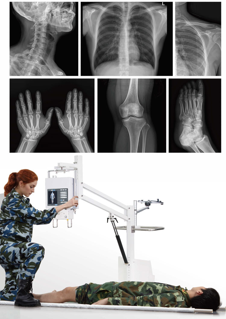 Hospital Radiology Mobile Analogue or Digital Medical X-ray Equipment