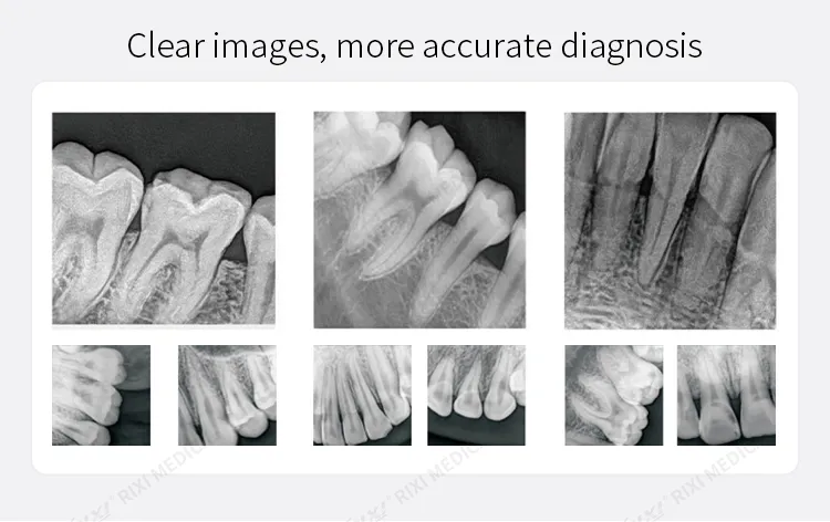 Clear Diagnosis Images
