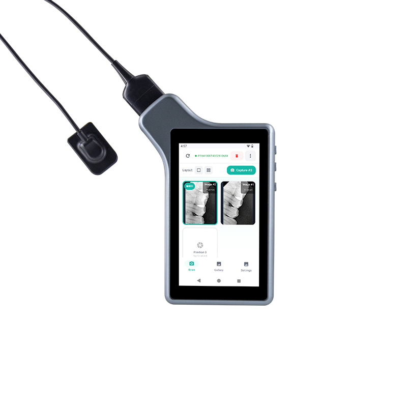 LK-C600Pro Dental Portable Intra Oral Imaging System for Immediate Diagnoses