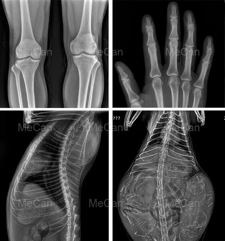 X-ray Full View