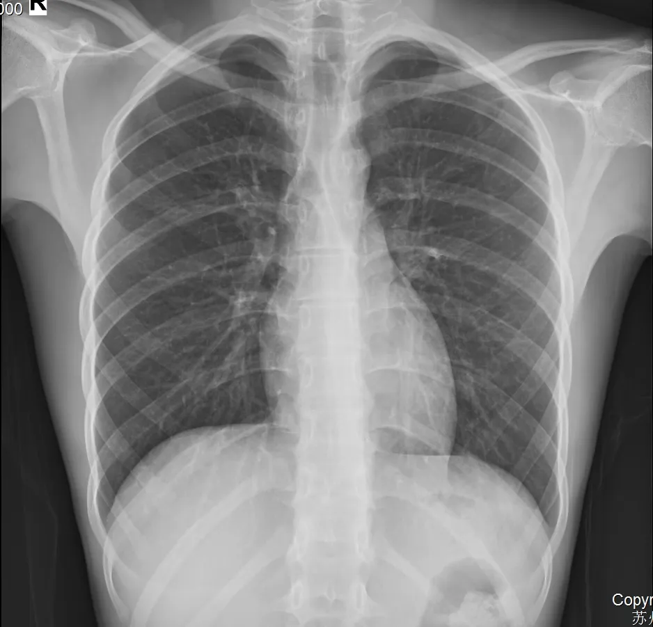 Digital Wireless X-ray Detector View 2