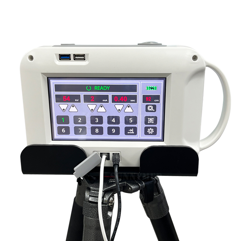 Sy-D034 Hospital Human and Animal Use 85kv Portable X Ray Device