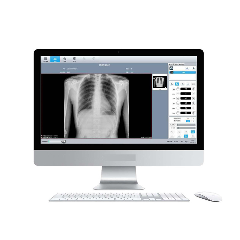 X-ray Machine Dr System Acquisition Workstation Software 50kw X-ray