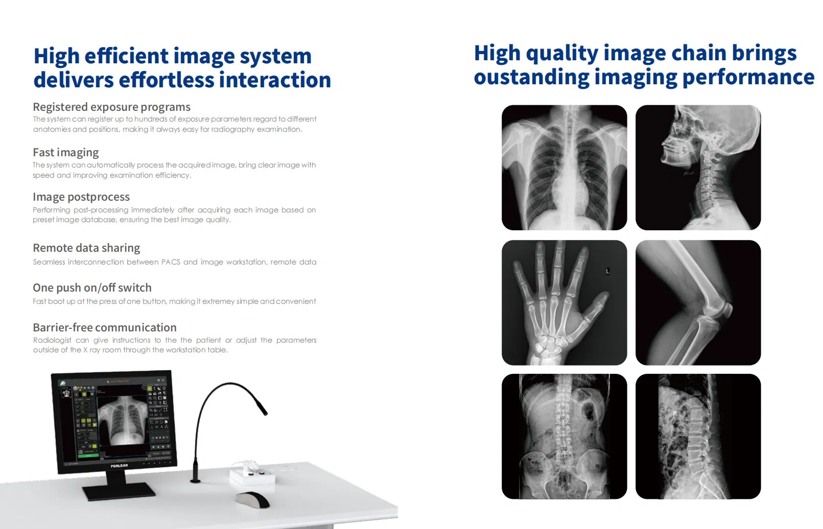 High-Resolution Floor X-ray System for Accurate Diagnostic Imaging