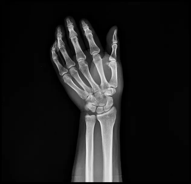 DR System Component 2