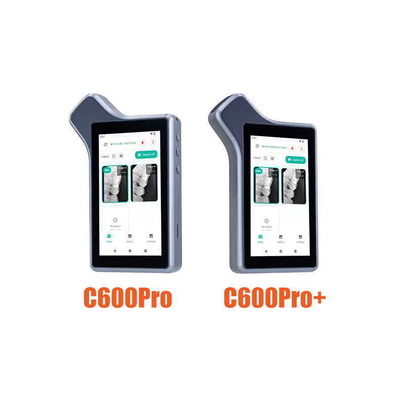 LK-C600Pro Dental Portable Intra Oral Imaging System for Immediate Diagnoses