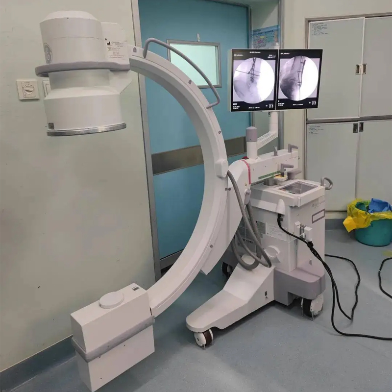 Portable C-Arm X-ray System for Surgical and Radiology