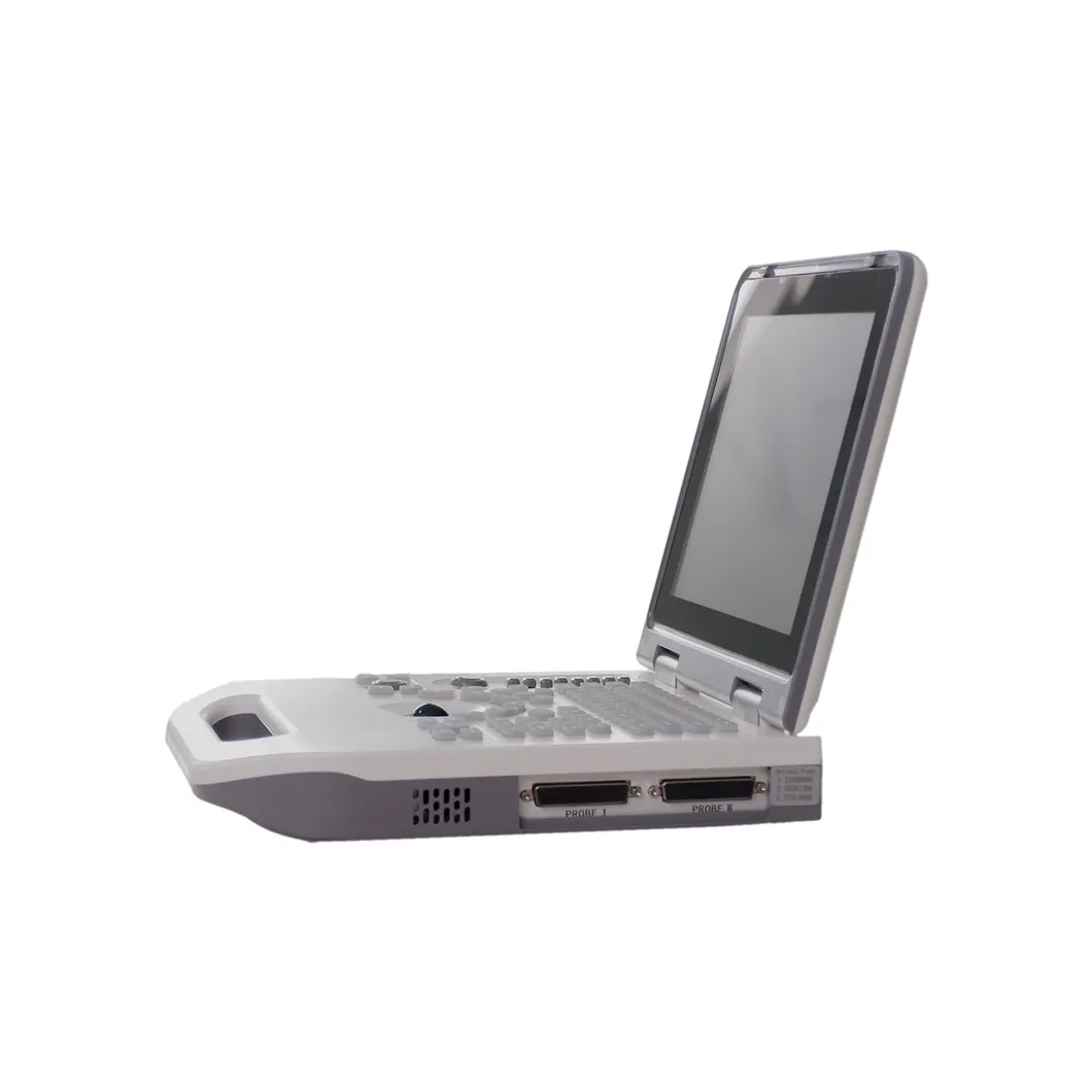 U20 Ultrasound System View 4