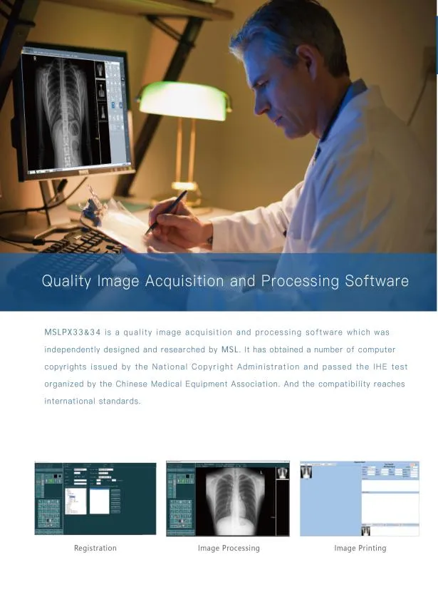 Digital Xray Machine Detail