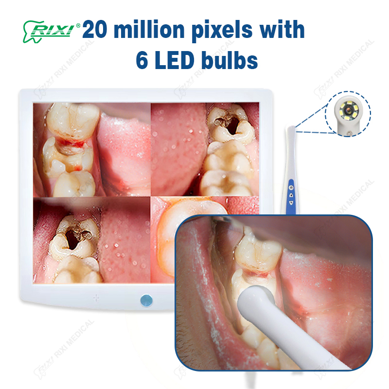 Professional Dental 3D Scanner and Oral Scanner Imaging Equipment for Dentists