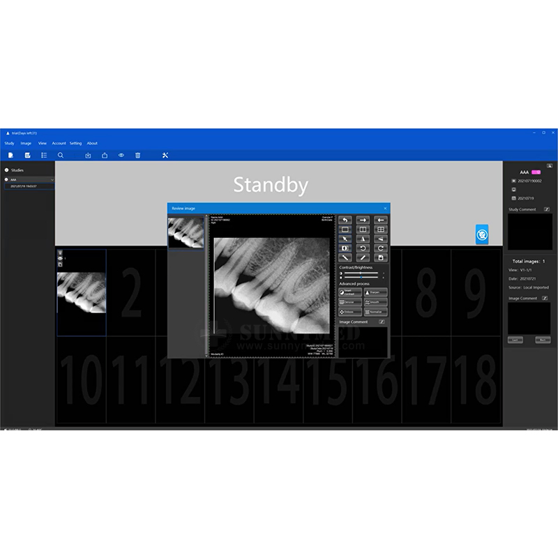 Sy-D042-2 Good Quality Dental Image Sensor Imaging System for Human Use Veterinary Use