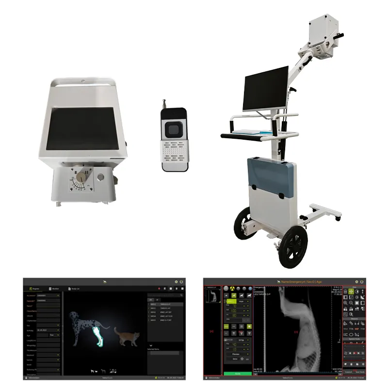 Portable X Ray System 4
