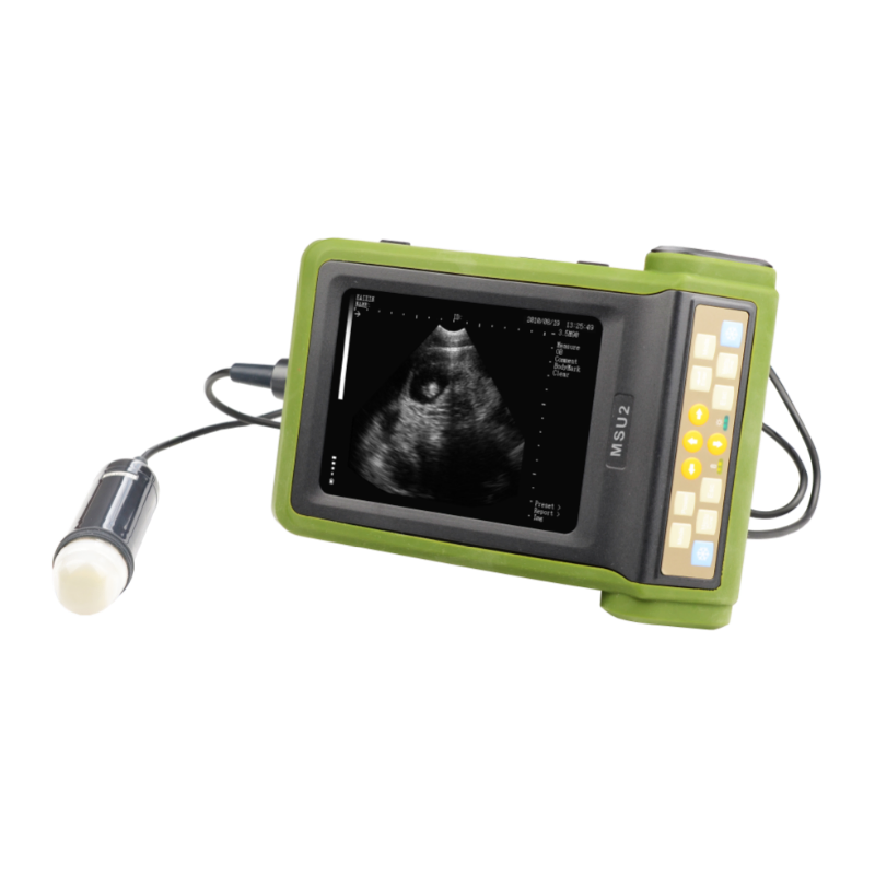 Ultrasound Scanner View 1