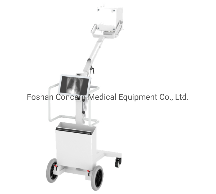 Medical Hospital Radiology Department 100mA 5kw High Frequency Portable Mobile X-ray Equipment