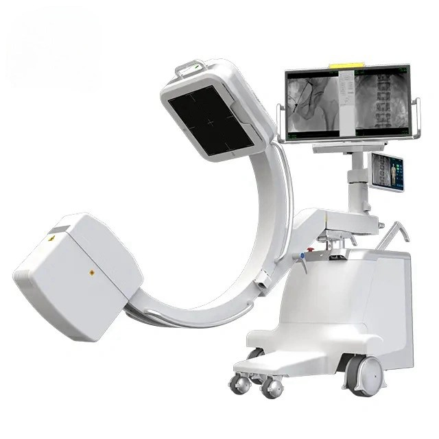 Advanced Mobile C-Arm X-ray System with High-Resolution Imaging Technology