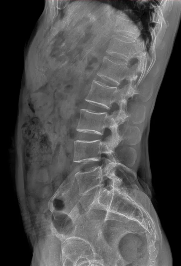 X-ray Image 1