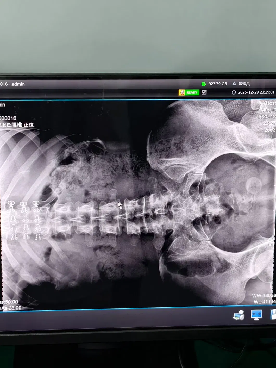 Radiography detail 3