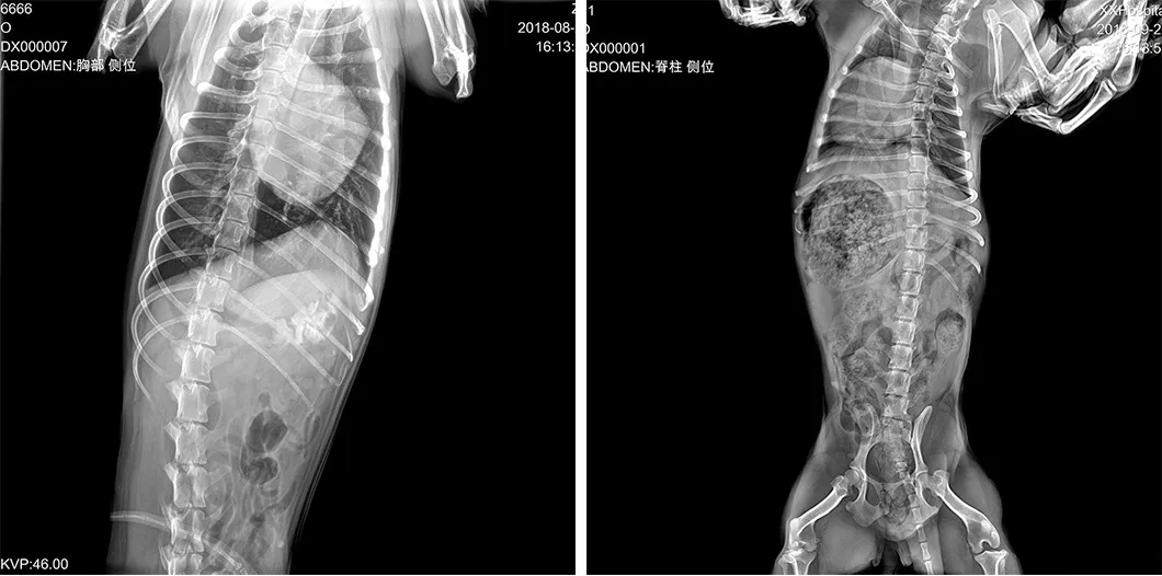 Digital Flat Panel Detector 4